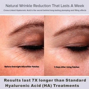 Ha MiSa plus reduce the appearance of skin wrinkles